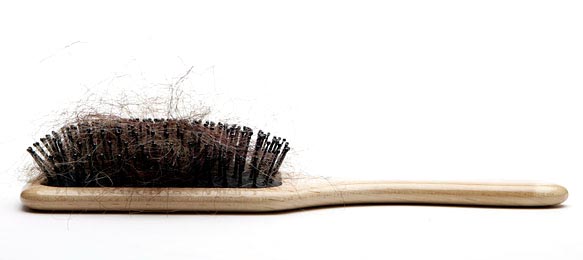 Ny Times: Female Hair Loss Ny Times: Female Hair Loss - -