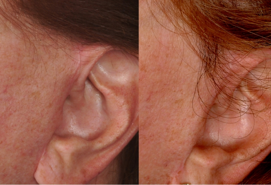 Especially For Women Especially For Women - -