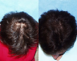 Bauman-Female-Patient