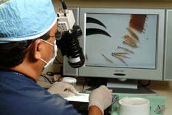 Hair Transplant Surgery Hai-Transplant-Videoscope