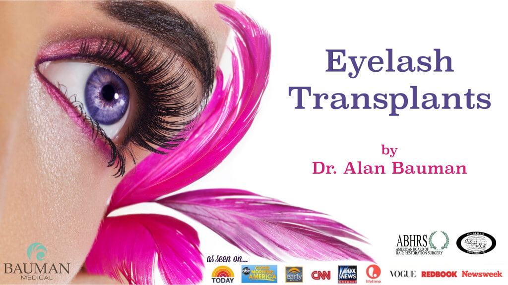 Eyelash Transplant And Implant Procedure Eyelash-Transplant-And-Implants