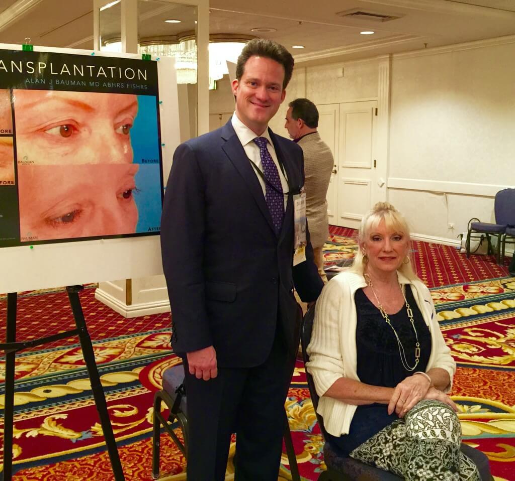 Dr. Alan Bauman And Team Participate In #Ishrs2015 Chicago Annual Scientific Meeting Dr Alan Bauman'S Eyelash Transplant_Trichotillomania_Livepatientviewing Ishrs2015 Chicago