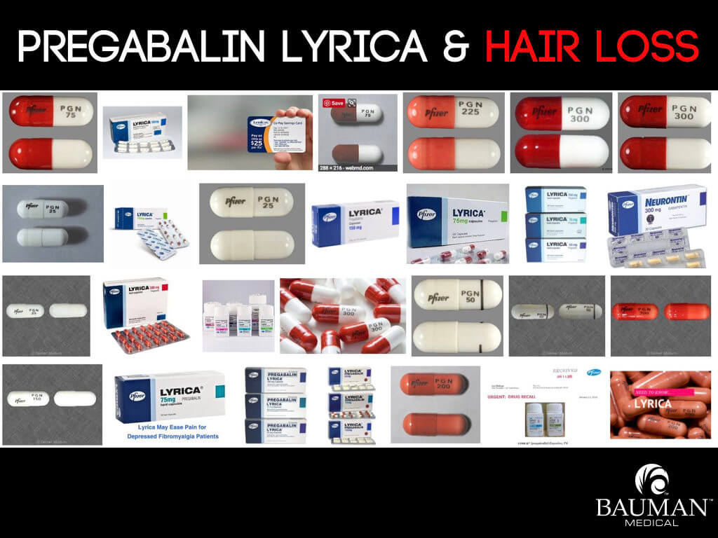 Does Gabapentin Make Your Hair Fall Out? Pregabalin Lyrica Gabapentin Neurontin ≪A Href=