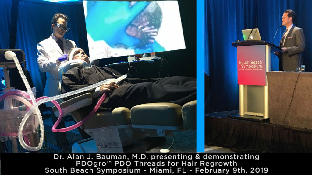 Press Release: Dr. Alan J. Bauman First In Usa To Use Pdogro™ Pdo Thread Procedure For Hair Regrowth Pdogro Demo+Lecture_Dralanbauman_Sbs