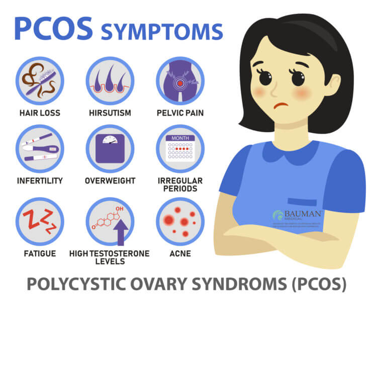 How to Avoid and Treat PCOS Hair Loss