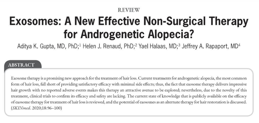 Exosomes For Hair Loss &Amp; Hair Restoration? Exosomes New Effective Non-Surgical Hair Loss Therapy - Androgenetic Alopecia