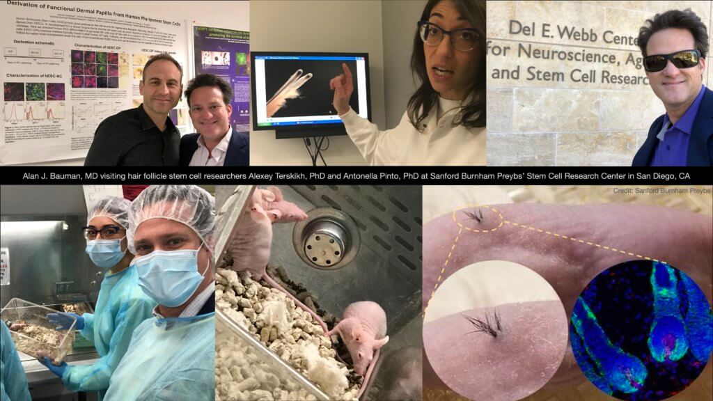 Regenerative Medicine In Hair Restoration Stem Cell Hair Follicle Research Ipsc Alexey Terskikh Dr Alan Bauman