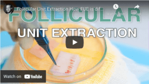 How To Get A Full Head Of Hair That Lasts Forever How To Get A Full Head Of Hair That Lasts Forever - -