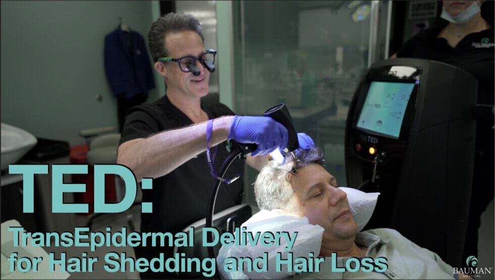 Introducing Alma Ted Transepidermal Delivery For Hair Shedding And Hair Loss Introducing Alma Ted Transepidermal Delivery For Hair Shedding And Hair Loss - -
