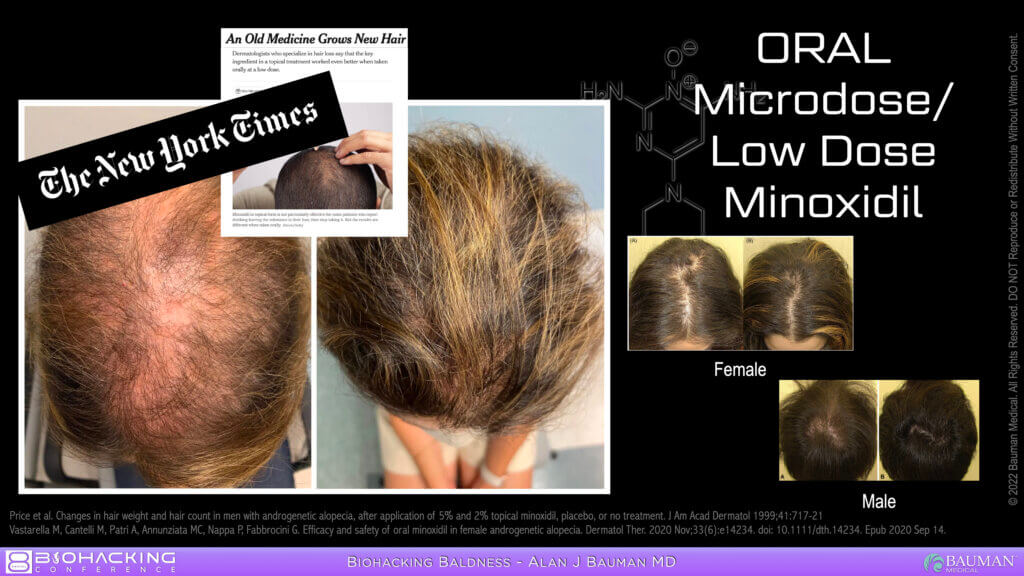 Low Dose Oral Minoxidil For Hair Regrowth Oral Low Dose Minox Hair Growth Biohackingconference Dralanbauman