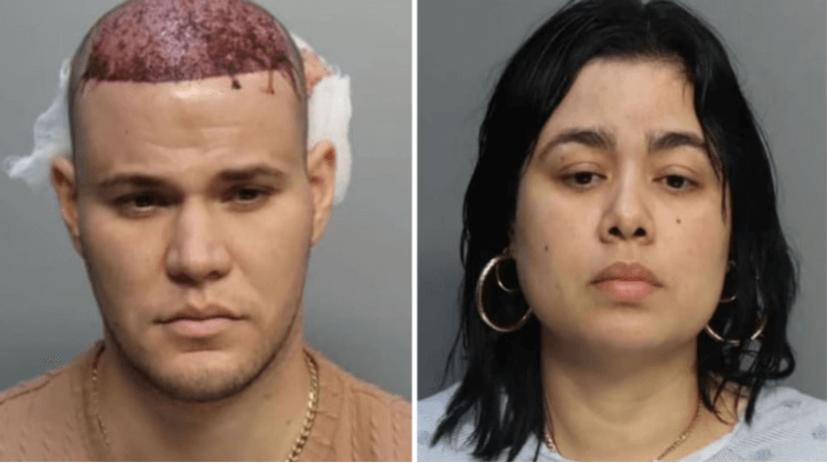 Beware of ‘Turkey Techniques’: The Hidden Dangers of Low-Cost Hair Transplants