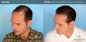 No Tricks, All Treats – Spook-Free Solutions For Scary Hair Loss No Tricks, All Treats – Spook-Free Solutions For Scary Hair Loss - -